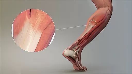 Magnified_view_of_a_Tendon
