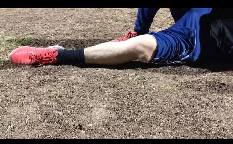 Patella instability - photo of knee dislocation with player lying on the field of play.