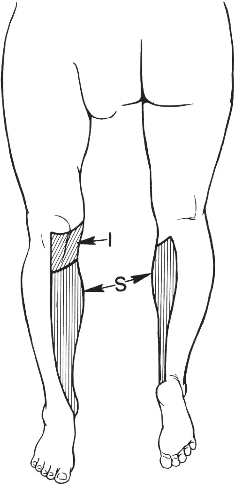 Picture describing the area of sensation of the inferior branch of saphenous nerve and the saphenous nerve.